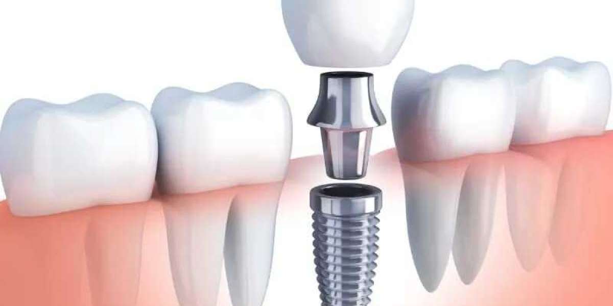 Enhanced Diagnosis and Patient Understanding: Intraoral Camera Services in McKinney, TX